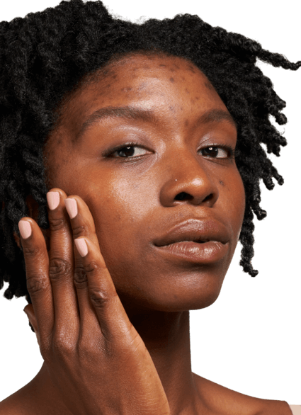 Four Curology products — Gentle Cleanser, Cream Moisturizer, Everyday Sunscreen (spf 30) and Emergency Spot Patches —  against a beige background